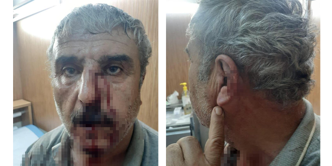 Doktor ile emekli öğretmenin mesai kavgası karakolda bitti