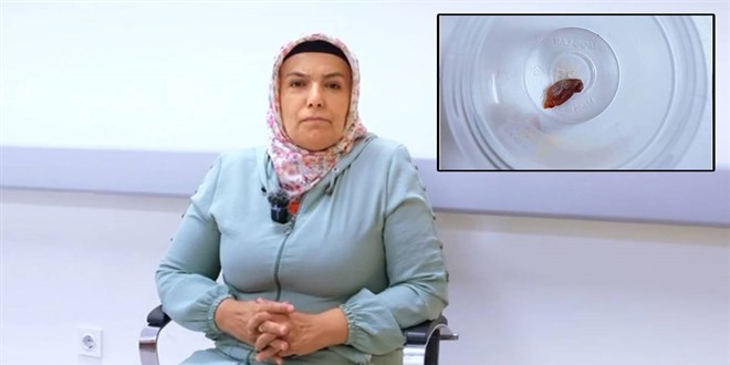 1,5 y�ll�k �ks�r���n nedeni, kabak �ekirde�i ��kt�