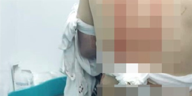 stanbul'da abisini sokak ortasnda silahla vurdu