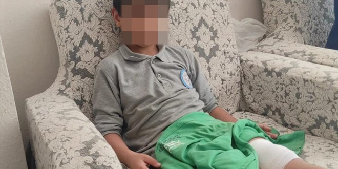 Okul yolunda başıboş köpeğin saldırısına uğradı