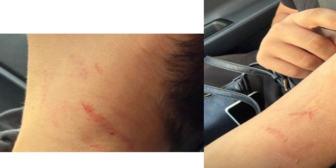 Ankara'da okulda iddet: Kz renci erkek arkadan tokatlad, trnaklad