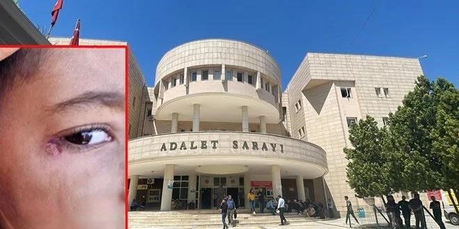 İlkokul öğrencisinin yüzünde sigara söndüren temizlik görevlisi tutuklandı