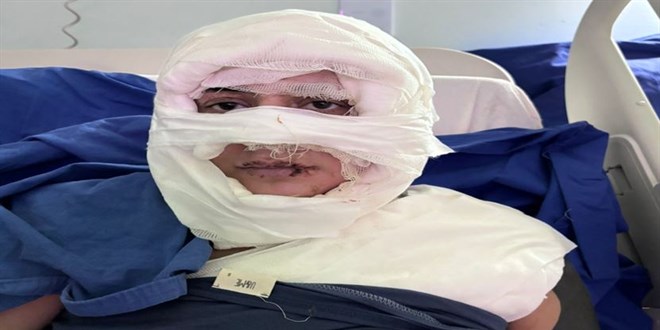 Gen kadn baka bir kadn tarafndan atee verildi