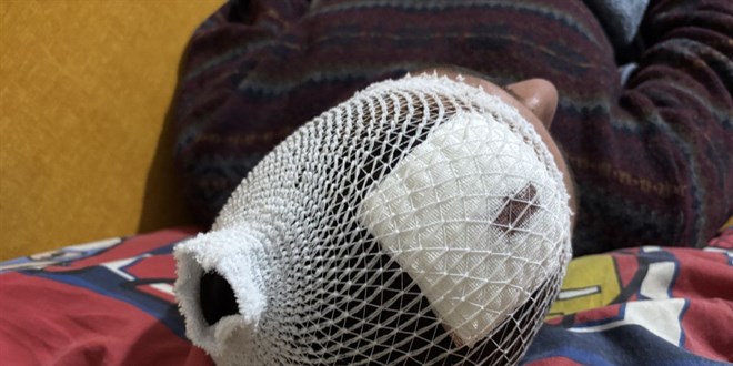 Kocaeli'de otizmli ahs odunlua bakt diye odunla darbedildi - Son Dakika Haber