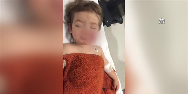 Bakentte pitbull'un saldrsna urayan 2 ocuk yaraland - Son Dakika Haber