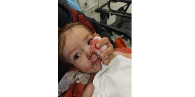 Ankara'da iki kardee saldran pitbull ve sahibi yakaland - Son Dakika Haber