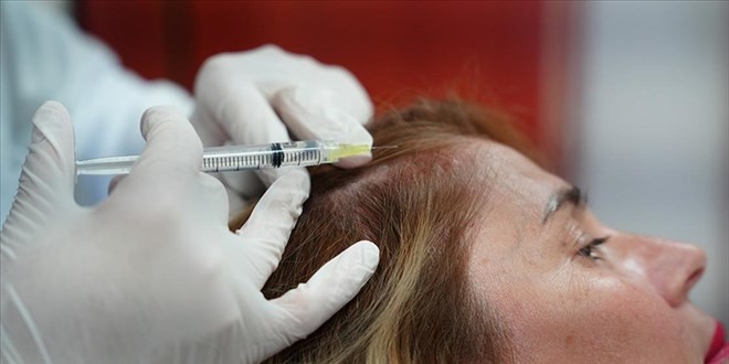 Migren hastalna akupunktur derman oldu