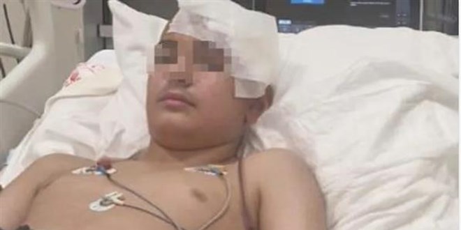 13 Ya��ndaki �ocuk, Kendi Ya��t�n�n Kafas�n� Ta�la Ezdi - Son Dakika Haber