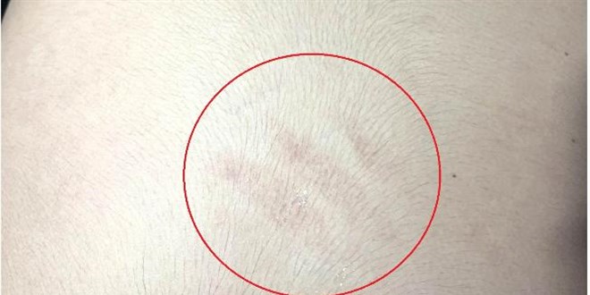 Ankara'da otizmli �ocu�a ��retmen �iddeti iddias�!