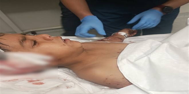 Okul ��k��� sokak k�peklerinin sald�rd��� 8 ya��ndaki �ocuk yaraland�