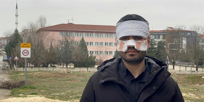 ��retmen ��retmeni yakt�. Y�z�ne s�cak �ay f�rlatt�! - Son Dakika Haber