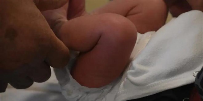 S�nnet edilen 27 g�nl�k bebek �ld�! Doktora soru�turma a��ld� - Son Dakika Haber