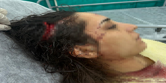 Bakkala giderken sokak k�peklerinin sald�r�s�nda yaraland�