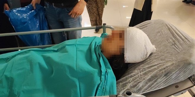 Adana'da ba��bo� k�pekler kad�na sald�rd�