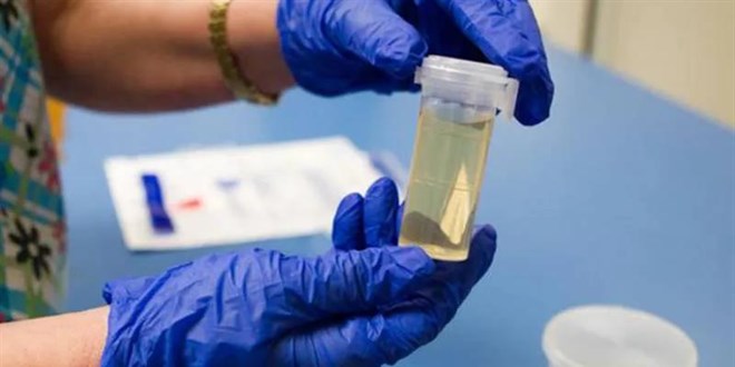 ��e al�mlarda 'uyu�turucu testi' d�nemi... Kamu kurumlar� da talep ediyor