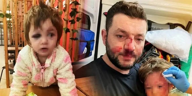 �kra bebek ile babas�n�n darp edilmesine dair iddianame haz�rland� - Son Dakika Haber