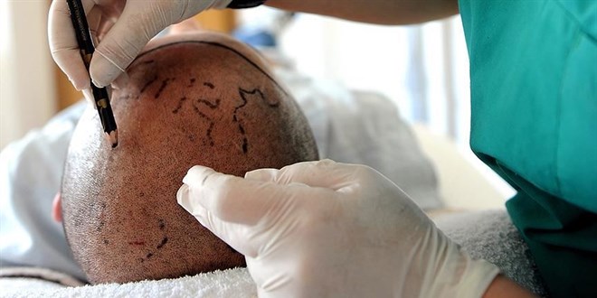 Sa� Ekimi: Fiyatlar, Y�ntemler ve Esteworld'de �talyan �izgisi D�nemi