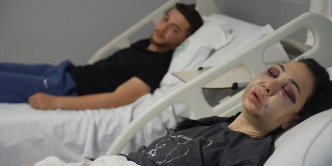 O�lunun g�z� �n�nde anneyi �ld�resiye d�vd�ler