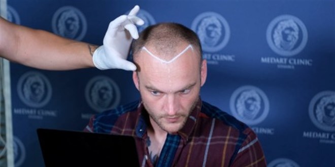 Top 10 Kad�nlar ��in En �yi Sa� Ekimi Klini�i: 2026'da T�rkiye'de �ne ��kanlar