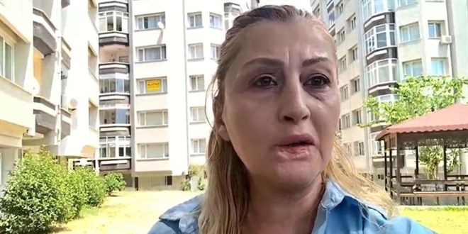 Estetik i�lem sonras� duda�� ��r�d�, 7 y�ld�r hukuk m�cadelesi veriyor