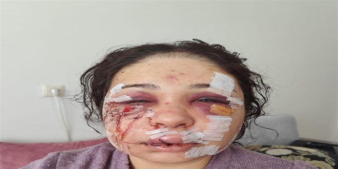 Bo�anma a�amas�ndaki e�ini darbeden polise hapis ve tahliye