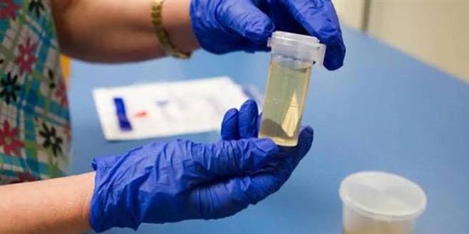 Ankara'daki uyu�turucu soru�turmas�nda test sonu�lar� ��kt� - Son Dakika Haber