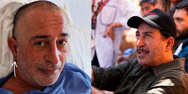 Cem Y�lmaz'�n kula��ndaki Frank �izgisi kalp krizinin habercisi mi? - Son Dakika Haber