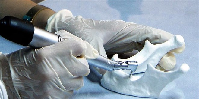 Alman mal� denilen implant Kore mal� ��k�nca Savc�l��a ba�vurdu