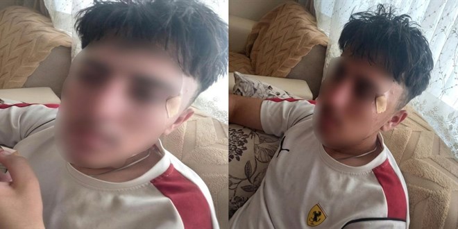 '��retmen, ��renciye kafa att�' iddias�: Savc�l�k soru�turma ba�latt�
