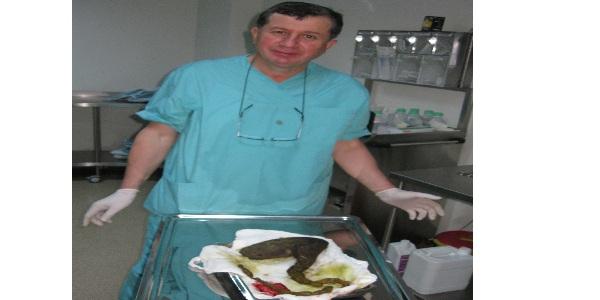 Midesinden saç yumağı çıktı