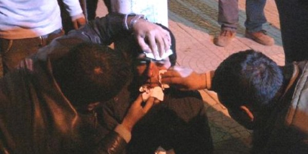 Otomobile �arpan motosikletli a��r yaraland�