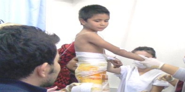 Pekmez kazan�na d��en �ocuk yaraland�