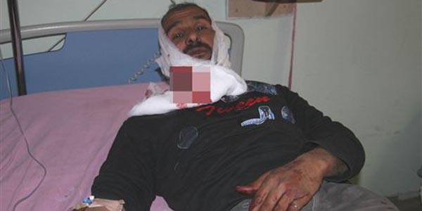 Suriye'den getirilen 12 yaraldan 1'i ld