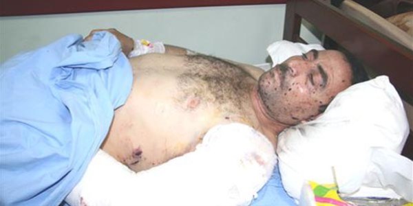 Suriye'den getirilen 8 yaral�dan biri hayat�n� kaybetti