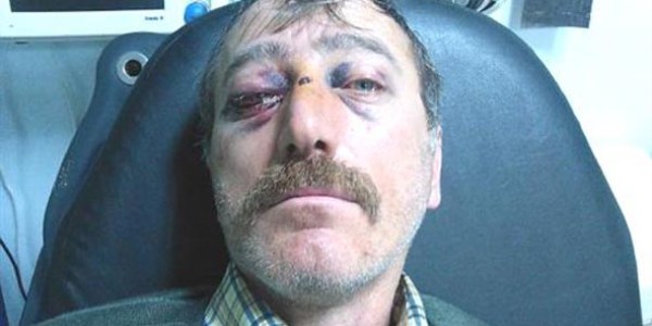 Doktor dövdürttü iddiası