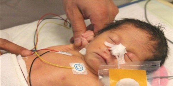 3 g�nl�k bebe�e yemek borusu ameliyat� yap�ld�