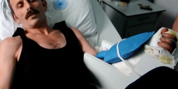 Belediye işçisinin kopan eli yerine dikildi