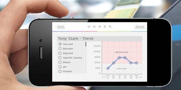 Akıllı telefonlar, şimdi de idrar testi yapacak/ Video