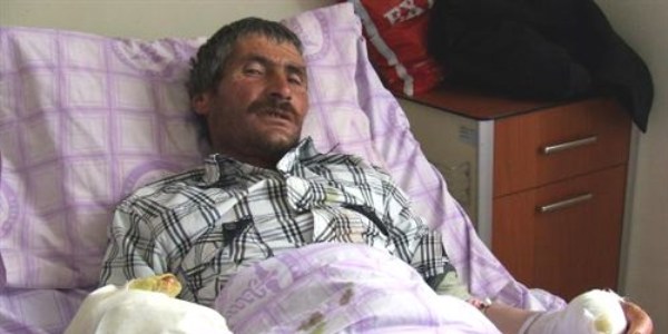 Kurdun kulağını ısırarak arkadaşlarını kurtardı