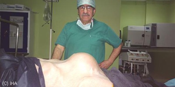 Vücudundan 40 santimetre uzunluğunda kitle çıkartıldı