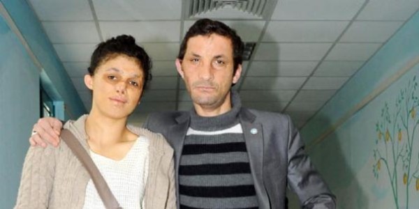Uğur Acar'ı görünce yüz nakline karar verdi
