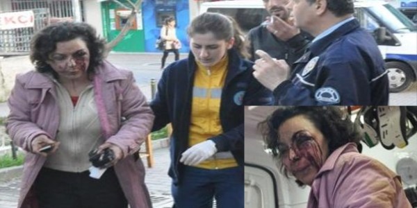 Dövdü sonra da telefonla arayıp 'nasılsın' dedi