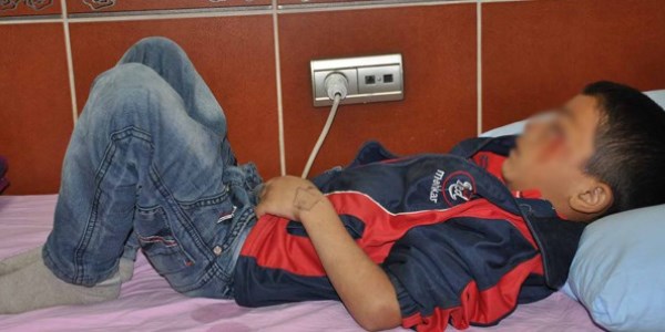 Gözüne kapı kolu çarpan öğrenci yaralandı