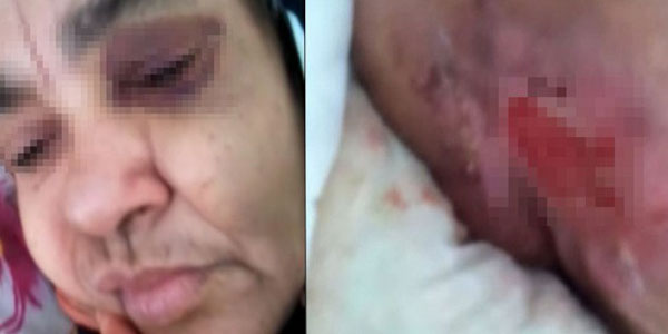 �zel bak�mevinde skandal g�r�nt�ler/ Video