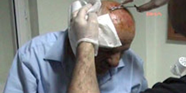 Belediye başkanı kazada yaralandı