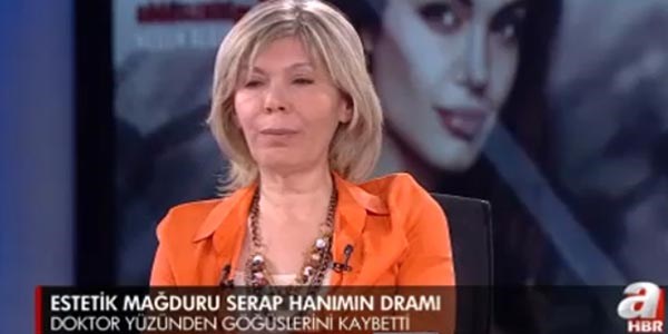 Ak�l almaz estetik skandal�