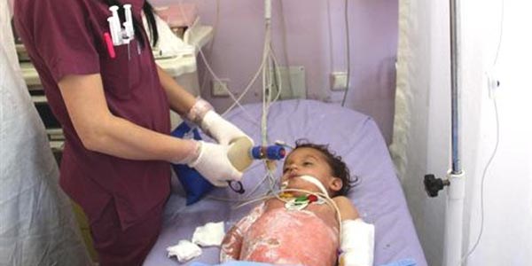 Minik kız kaynamış süt kazanına düştü
