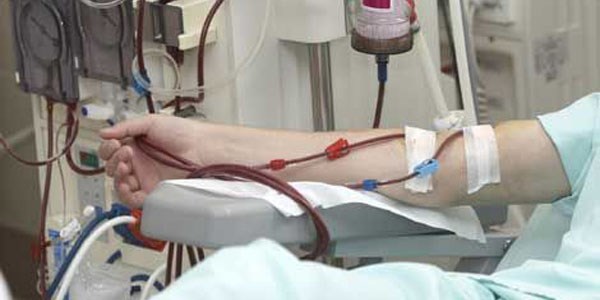 Türkiye'de, 22 bin 500 kişi organ bekliyor
