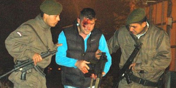 Polisin attığı kapsül yarbayı yaraladı/ Video