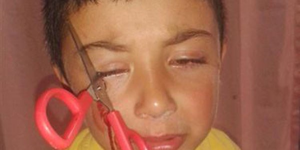 Sokakta oynayan çocuğun gözüne makas saplandı